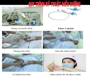 Quy trình truyền máu điều dưỡng – Các bước thực hiện Quy trình truyền máu điều dưỡng – Các bước thực hiện