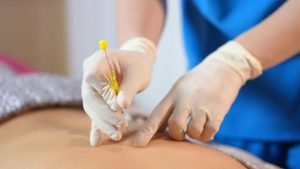 Các ứng dụng của phương pháp cấy chỉ