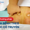 Các phương pháp chữa bệnh theo Y học Cổ truyền quý báu